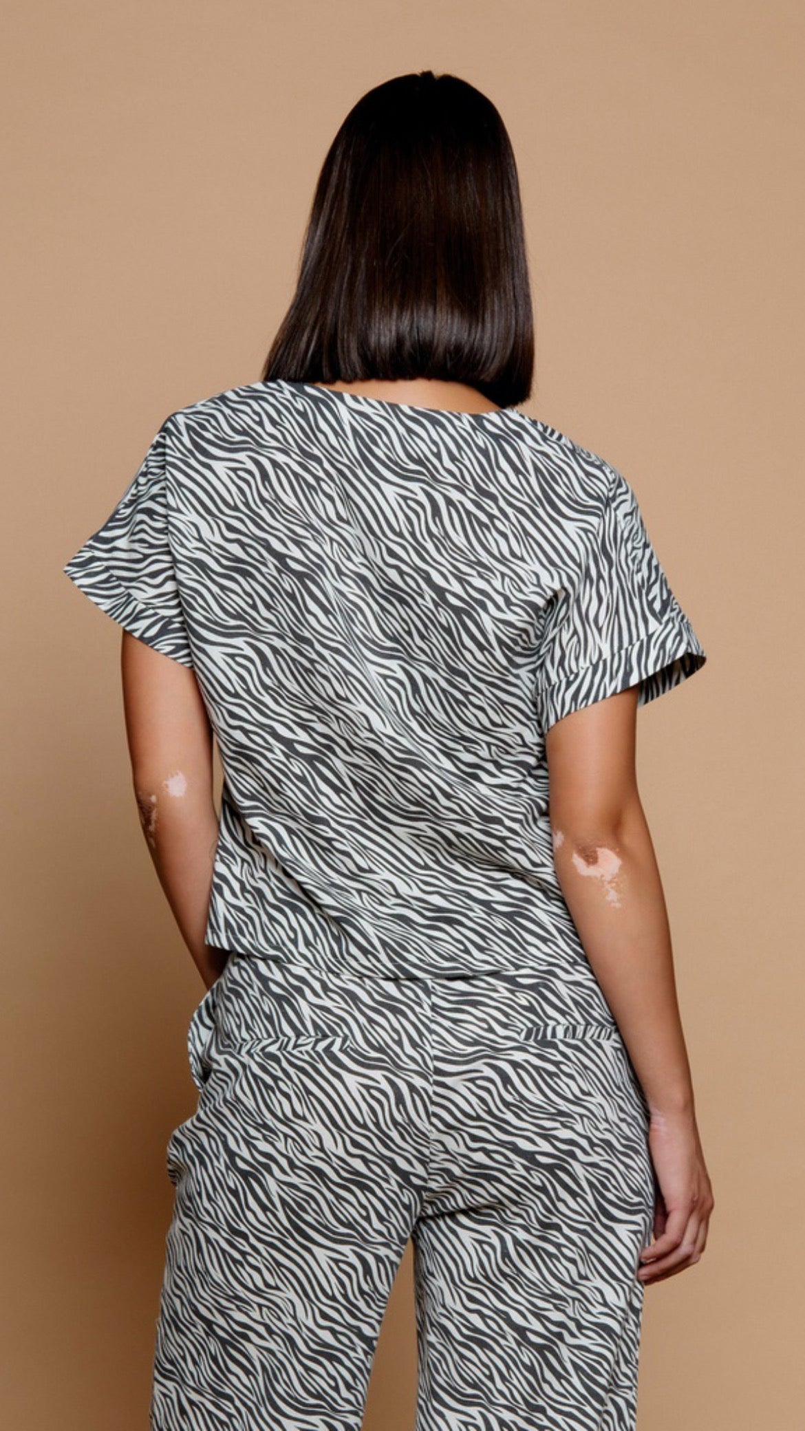 Zebra Top (R)