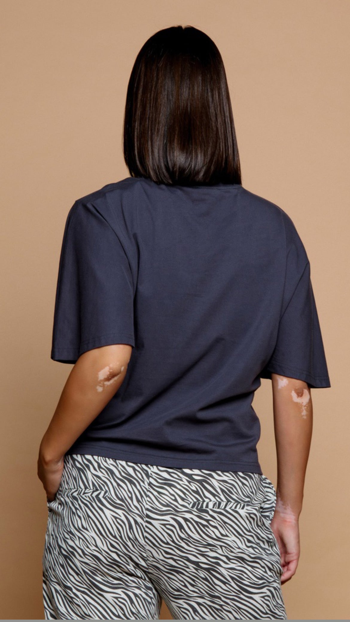 Tiger Top (R)
